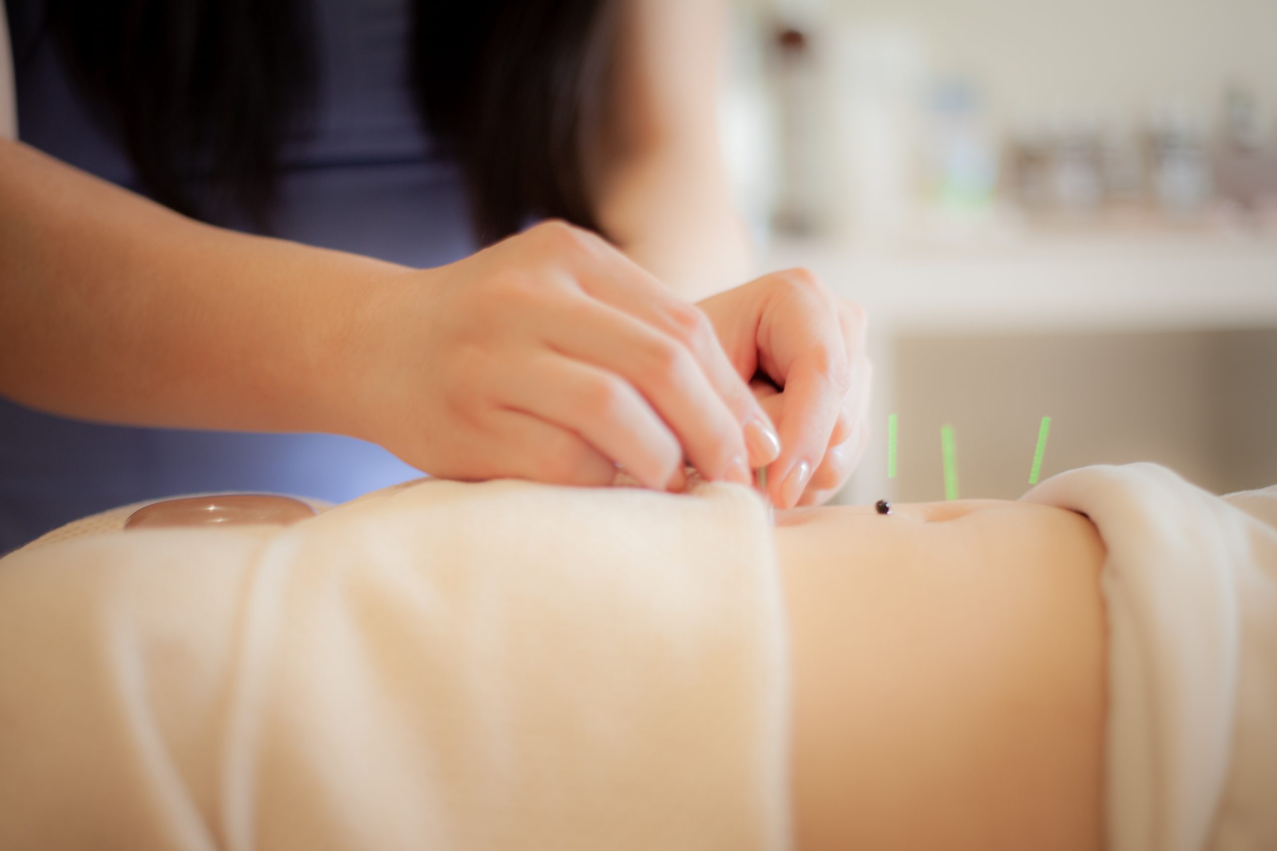 best acupuncture clinics in Edmonton by neighborhood wellness