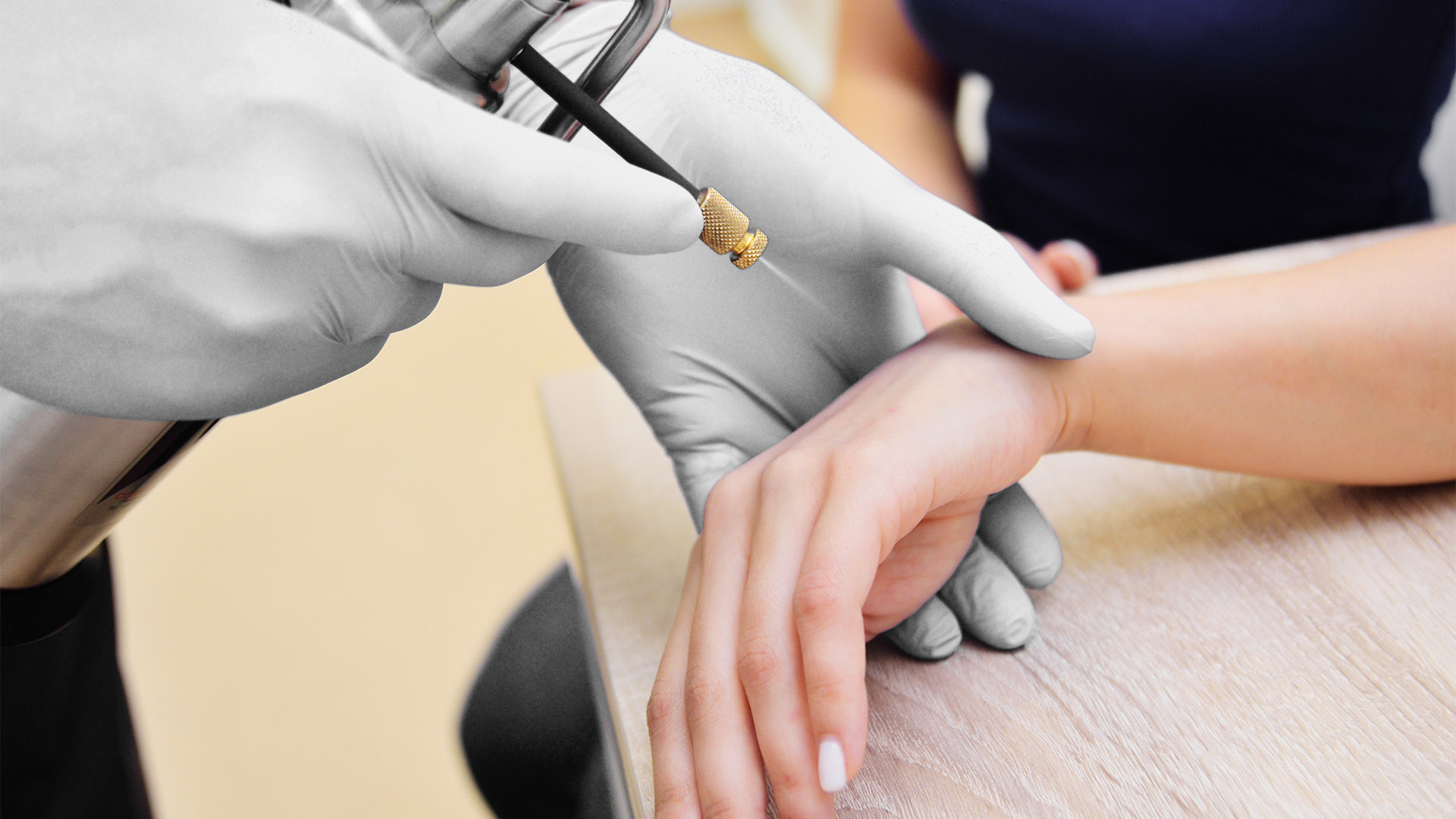 Localized Cryotherapy and Specialized Treatments