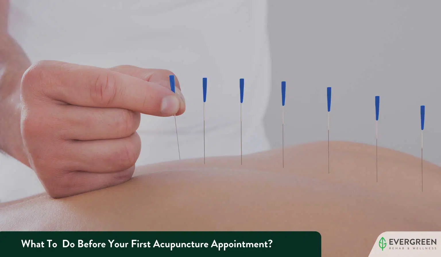 How to Prepare for Your First Acupuncture Appointment: An Edmonton Guide