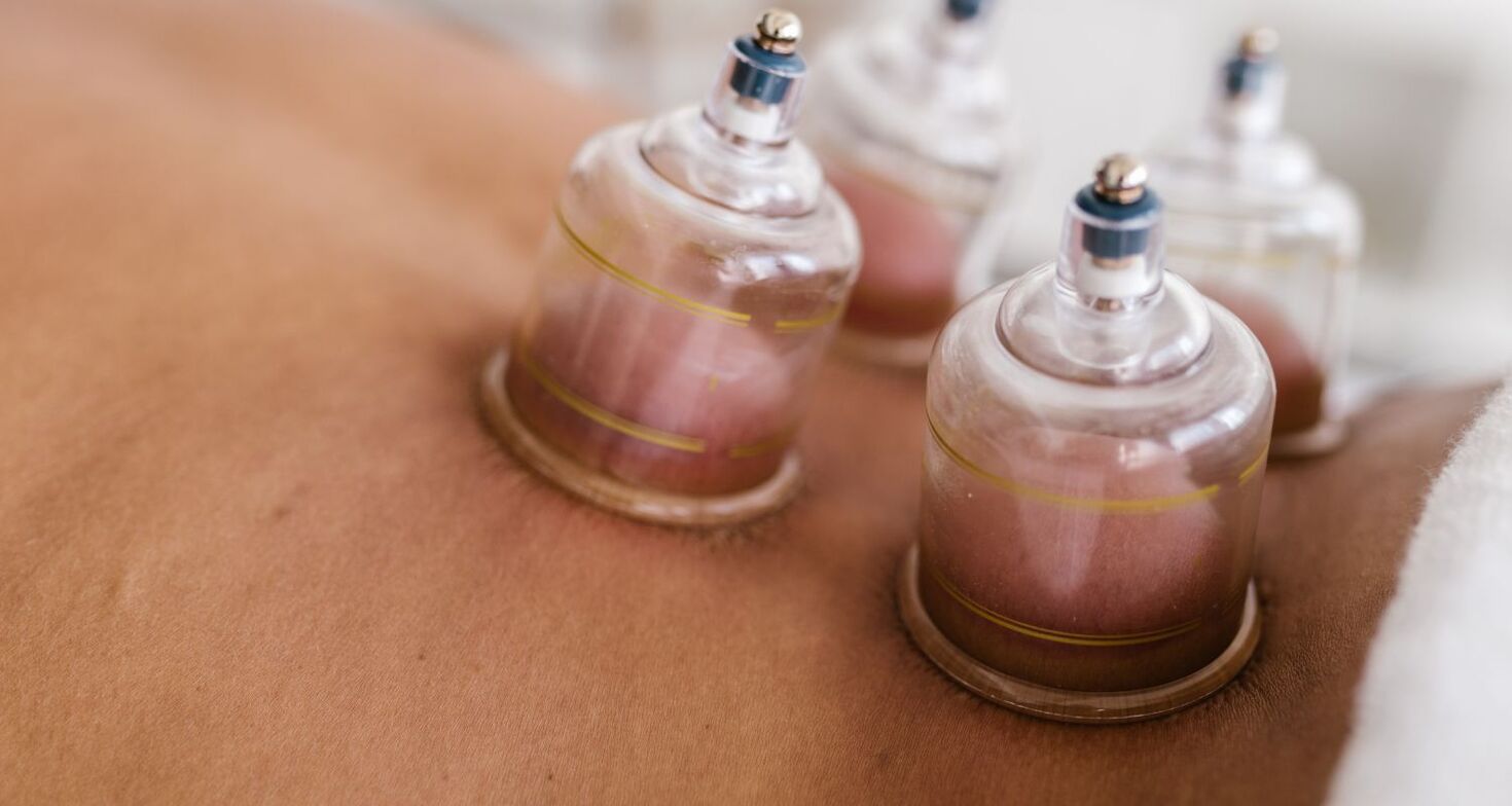 What to Expect During Your First Cupping Session