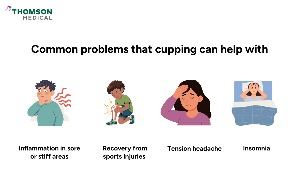 Why Try Cupping Therapy: Benefits and What to Expect at Edmonton Clinics