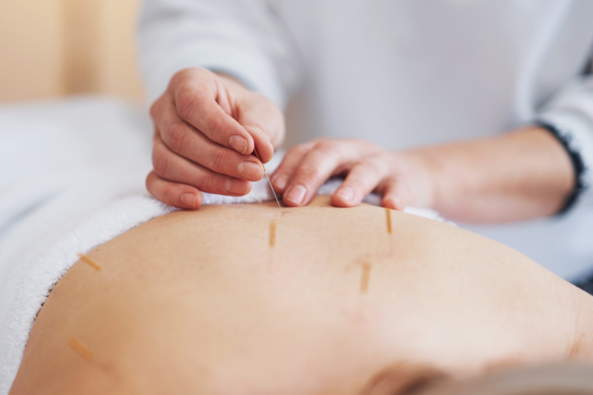 Common Conditions Edmontonians Seek Acupuncture For